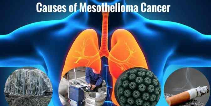 Mesothelioma Symptoms, Causes and Treatment